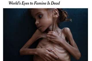 Au Yémen, Amal Hussain, petite fille devenue symbole de la famine est morte