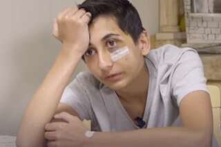 Gabriel, 14 ans et défiguré après une interpellation, s'exprime pour la première fois