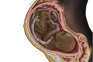 Cette illustration d'un fœtus noir ravive le débat sur la diversité en médecine