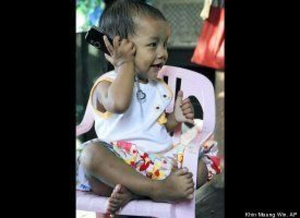 - Sixteen-month-old Le Yati Min plays on a chair at her house in South Okkalarpa township on the outskirts of Yangon, Myanmar, on Feb. 15. The Myanmar girl was born with six fingers on each hand and seven toes on each foot on Oct. 18, 2009. Guinness World Records is considering naming her the most "digitally enhanced" person in the world.
