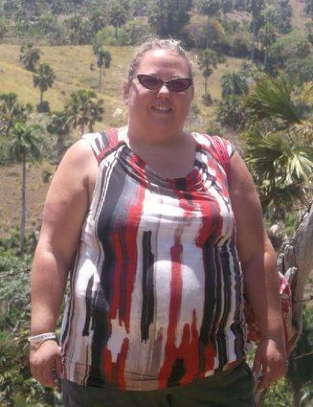 Melissa BEFORE - <a href="http://www.huffingtonpost.ca/2016/07/12/weight-lost_n_10944804.html" target="_blank">Read the story here.</a>