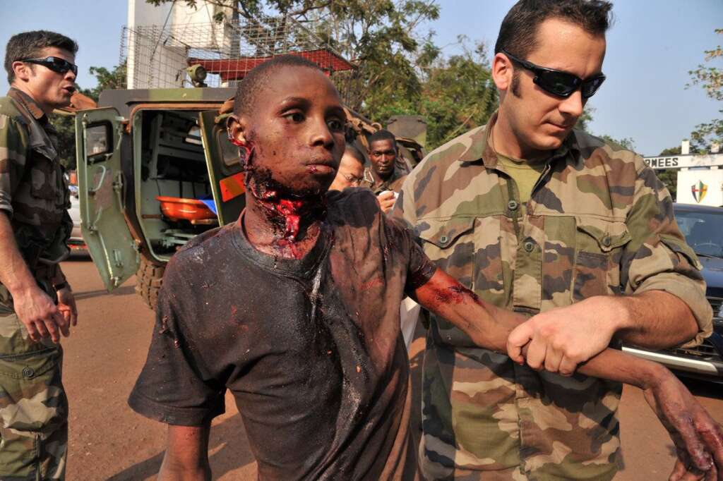 VUE PAR L'AFP - Alors que l'armée multiplie les clichés de désarmement (ce dont témoignent également les agences de presse), les images rapportées par les photoreporters témoignent des violences souvent choquantes qui se poursuivent en Centrafrique. Ici, un jeune homme grièvement blessé à la gorge, probablement à coup de machette, le 27 janvier 2014.