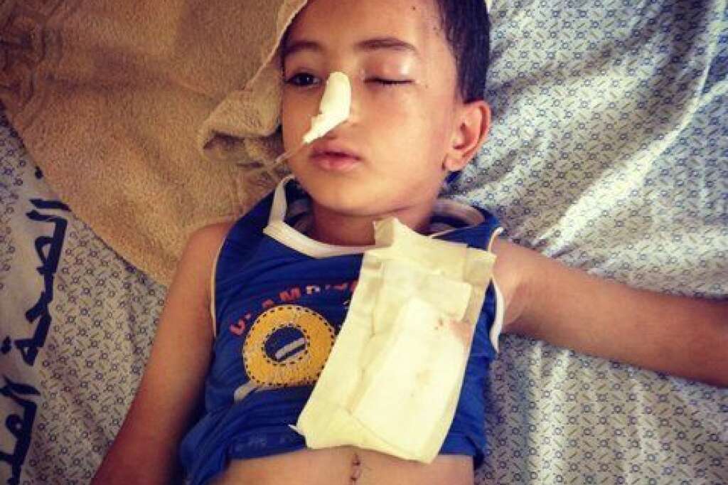 - Nour, 5 ans, se repose dans un lit à l'hôpital al-Shifa de Gaza. Ses deux parents ont été tués dans un raid aérien israélien mardi dernier, selon sa grand-mère. Au moins 33 enfants ont été tués ces derniers jours, selon un rapport du Fonds des Nations Unies pour l'enfance le dimanche.