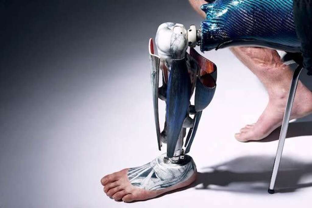 Le projet des prothèses alternatives -