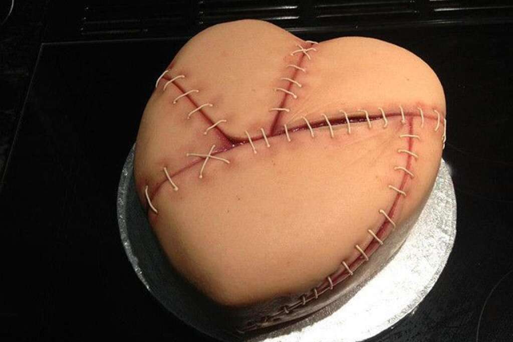 Le gâteau "points de suture" -