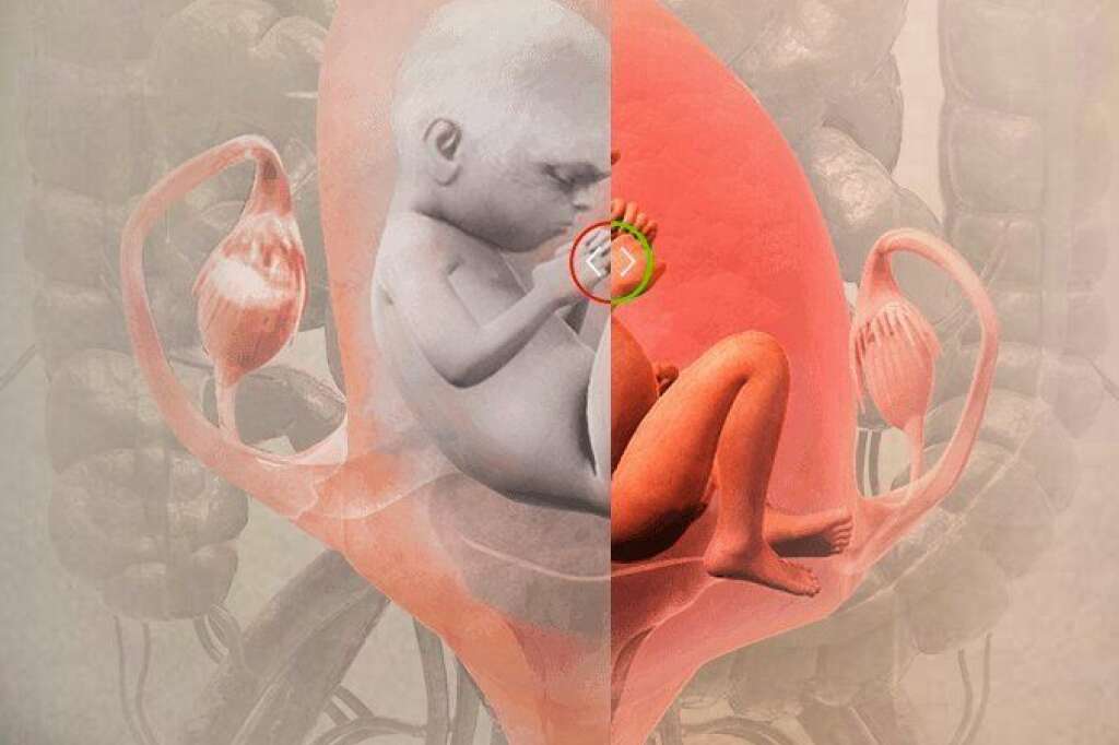 Sperme et grossesse - La densité de sperme des fumeurs est considérablement plus faible que celle des non-fumeurs. Les toxines des cigarettes réduisent la concentration et la mobilité des cellules de spermatozoïdes dans le sperme, et abiment ces cellules.   Le fœtus sur cette image est inquiet parce-que la mère fume. Les produits chimiques de la cigarette circulent sans filtre le long du cordon ombilical jusqu’au fœtus. Voici comment l’enfant à naître se trouve exposé à des niveaux encore plus importants et dangereux de produits chimiques que sa mère.