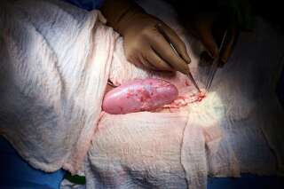 L'organe a été implanté à l'extérieur du corps pour permettre l'observation et l'échantillonnage des tissus au cours de la période d'étude de 54 heures