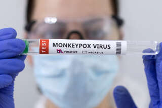 Feu vert au remboursement à 100% des tests pour la variole du singe