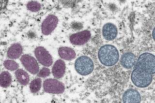 Ce que les dernières études disent du mode de transmission de la variole du singe