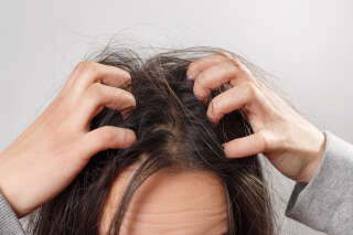 a young woman scratches her scalp and hair with her fingers. Hair health concept, scalp and hair care