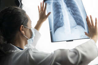 Cette étude sur la pollution révolutionne la compréhension du cancer du poumon