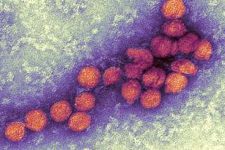 Des cas de virus du Nil occidental détectés en Gironde, une première hors du pourtour méditerranéen
