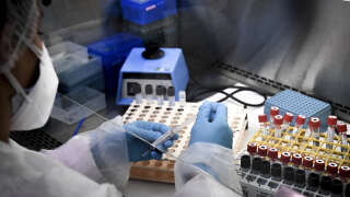 A lab technician prepares samples for PCR tests to screen for Covid-19 (novel coronavirus) at the Eylau Unilabs analysis laboratory in Neuilly-sur-Seine, outside Paris, on September 15, 2020. With the rising number of Covid-19 infections and a high demand by the public to be tested, French analysis laboratories are saturated. The Eylau Unilabs laboratory has set up a team who relay around the clock to carry out PCR Covid-19 screenings, averaging around 2000 tests per day. (Photo by ALAIN JOCARD / AFP)