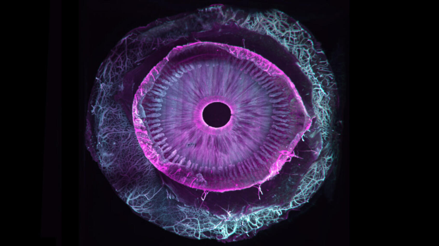 Dit menselijk oog is volledig transparant geworden, wat een kleine wetenschappelijke revolutie is
