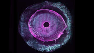 Questo occhio umano è diventato completamente trasparente, il che rappresenta una piccola rivoluzione scientifica