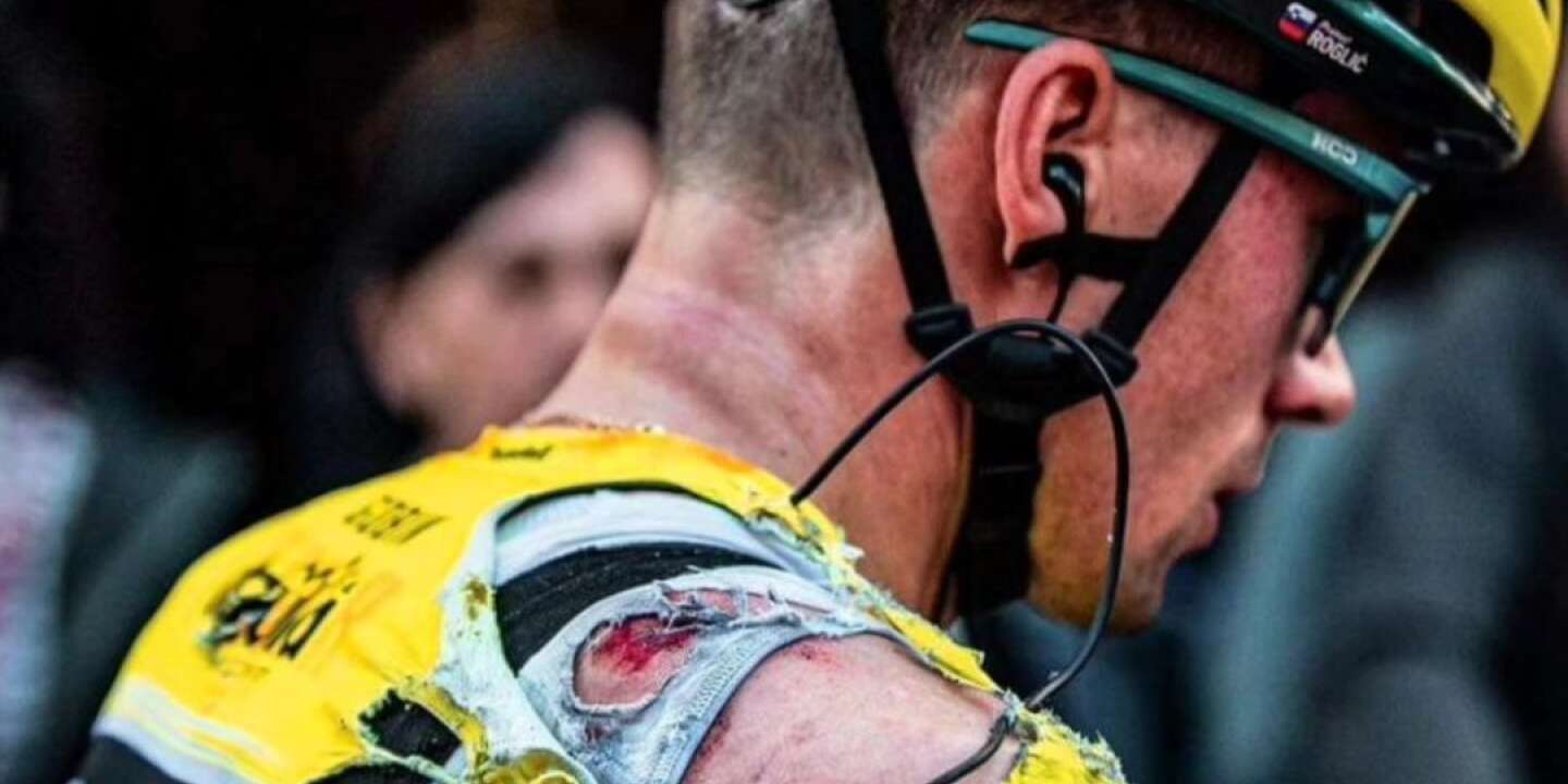 Le cycliste Primoz Roglic poste une photo de ses blessures après ses deux chutes lors du Tour du Pays basque