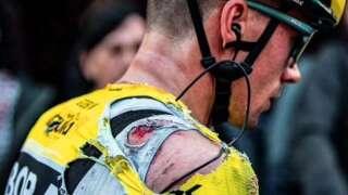 Le cycliste slovène publie des photos de son corps après sa lourde chute lors de la quatrième étape du Tour du Pays Basque