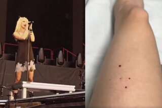 La chanteuse Taylor Momsen a été mordue par une chauve-souris lors d'un concert à Séville le 29 mai, en première partie d'AC/DC.